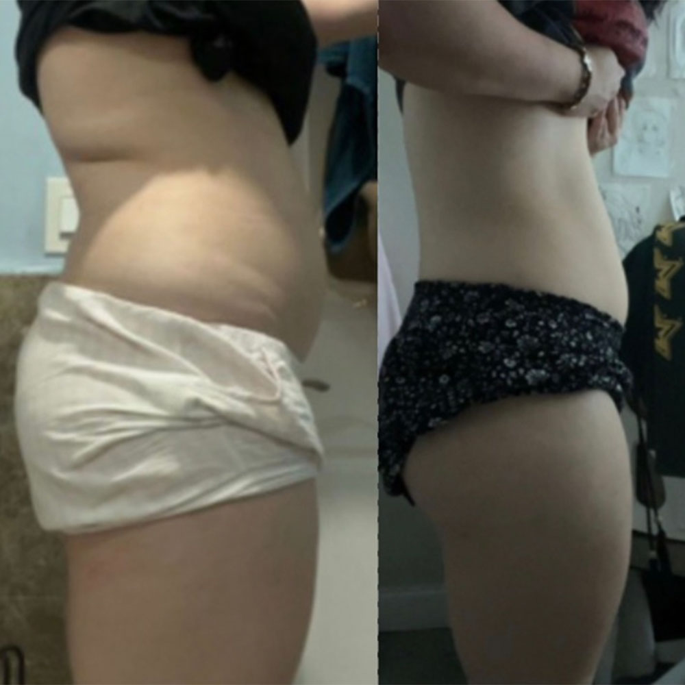 Transformation 4