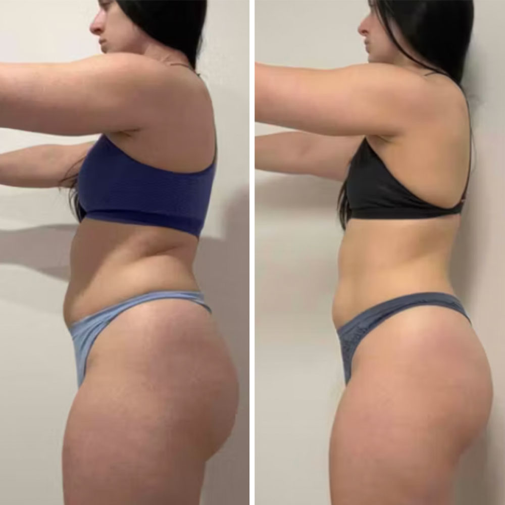 Transformation 8