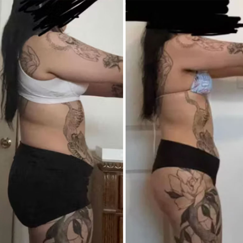Transformation 9